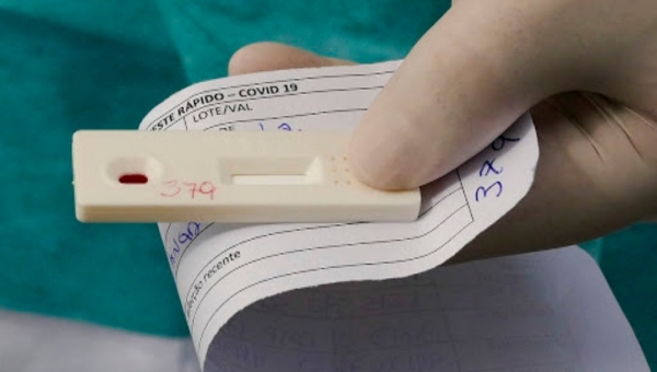 Acre confirma 84 casos de covid-19 nesta terça e registra mais duas mortes pela doença 